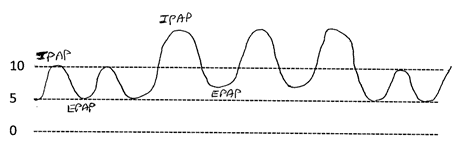 ASV pressure curve