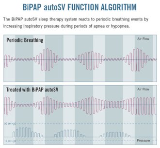 CPAP pressure curve