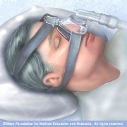 CPAP mask