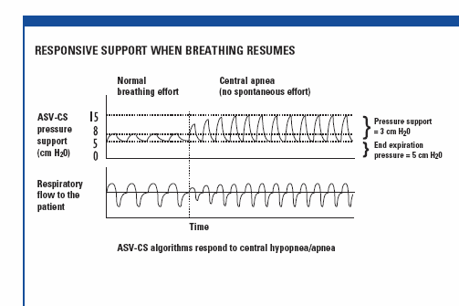 ASV pressure curve