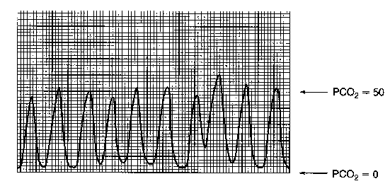 PetCO2 curve-COPD